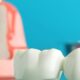 White ceramic dental crown bridge on a reflective surface with a blurred tooth cross-section model behind it