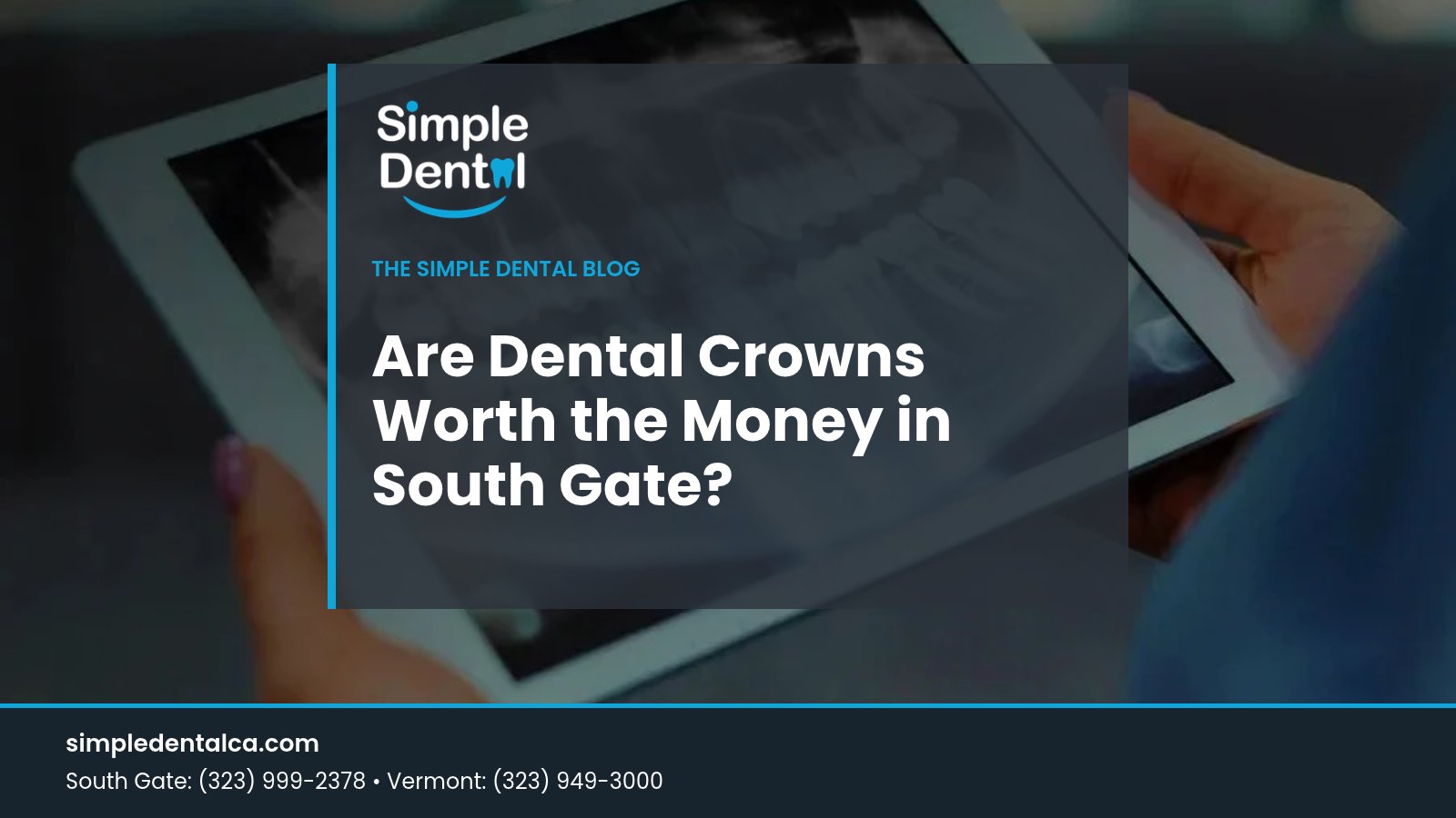 Dental X-ray on a tablet with the title Are Dental Crowns Worth the Money in South Gate, from Simple Dental