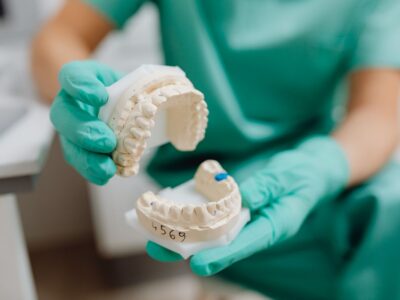 Gloved hands holding upper and lower plaster dental casts